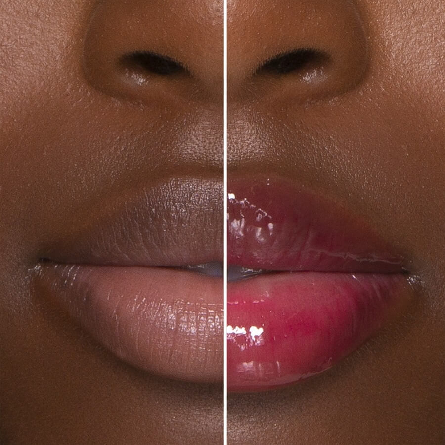 Lip Injection  Extreme