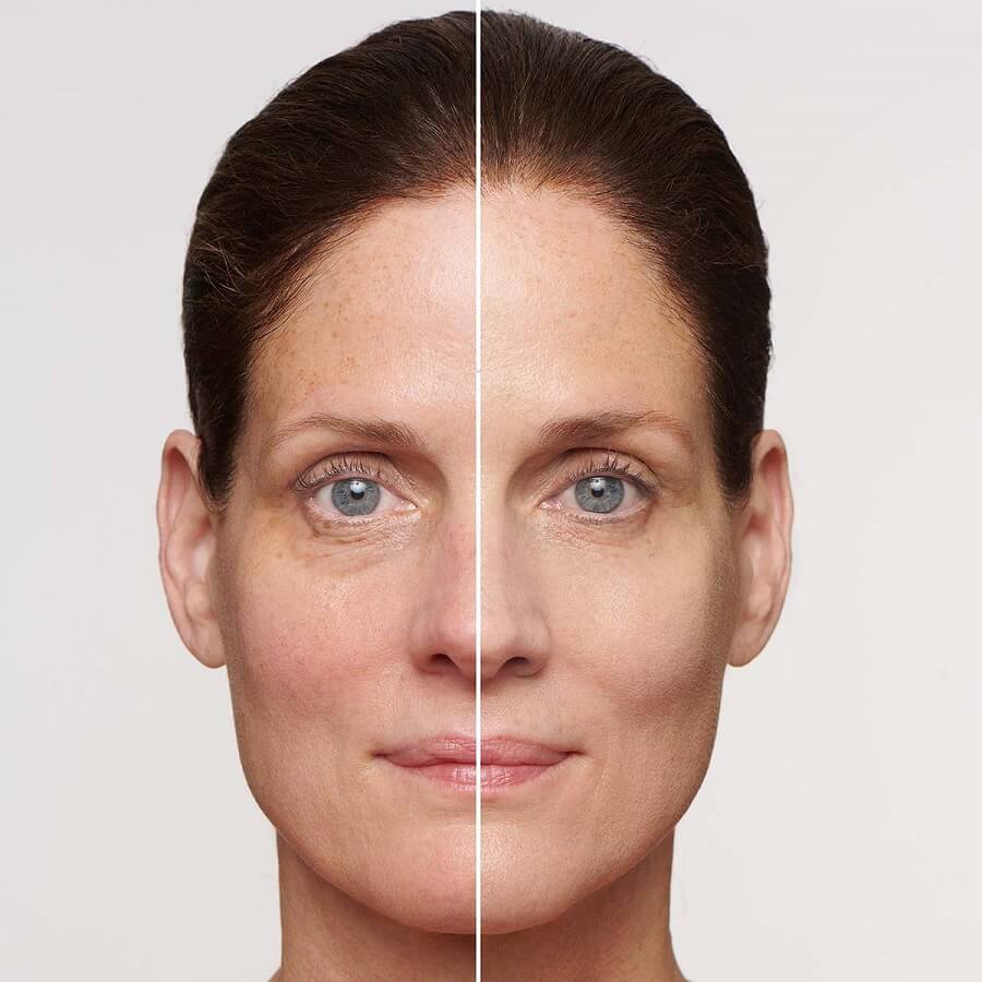 SOS Primer Redness