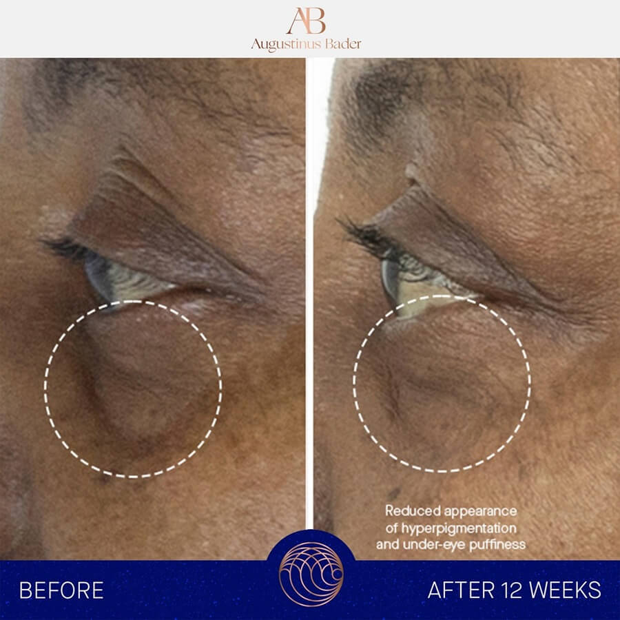 The Eye Cream Full Set