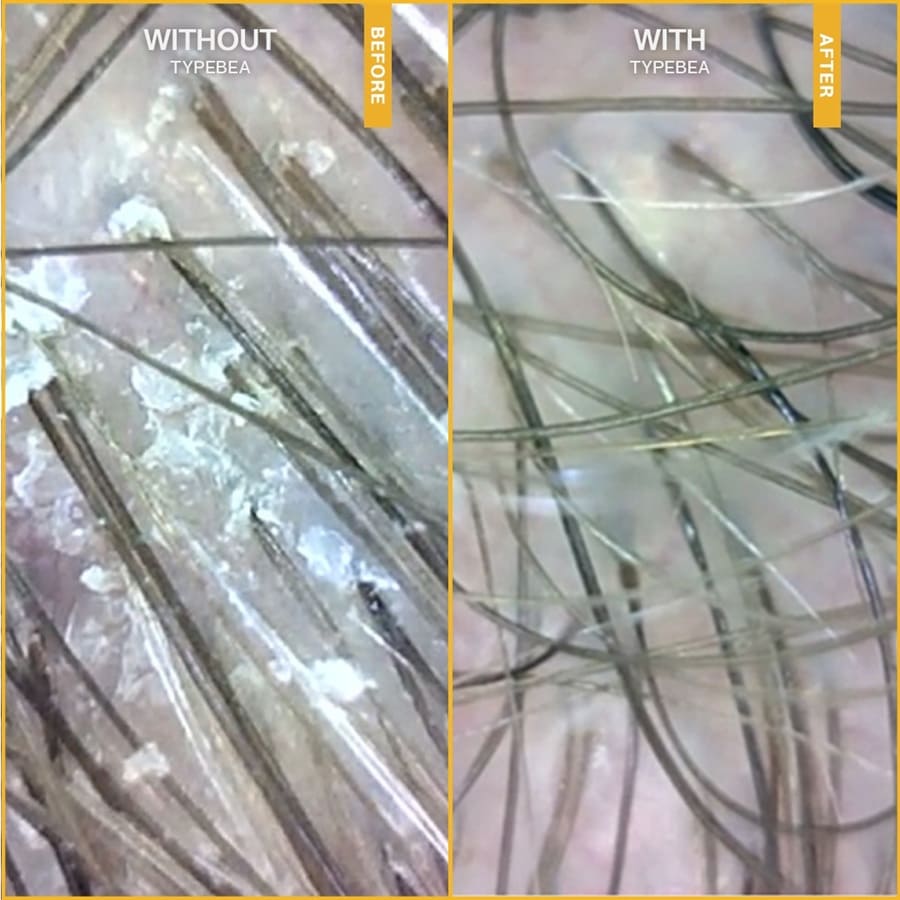G0 Exfoliating Scalp Treatment