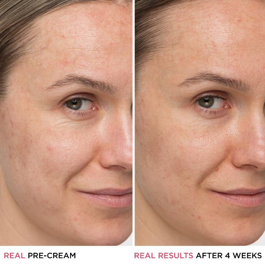 Confidence In A Cream Anti-Aging Armour