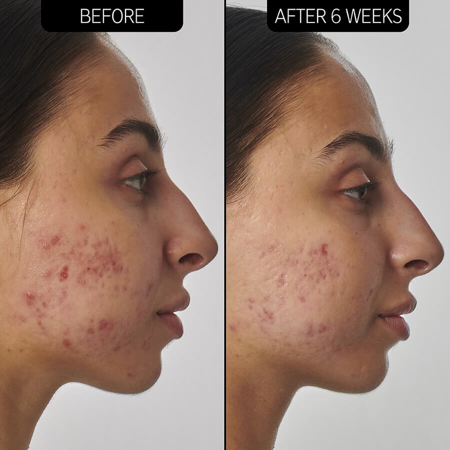 1% Retinol Serum