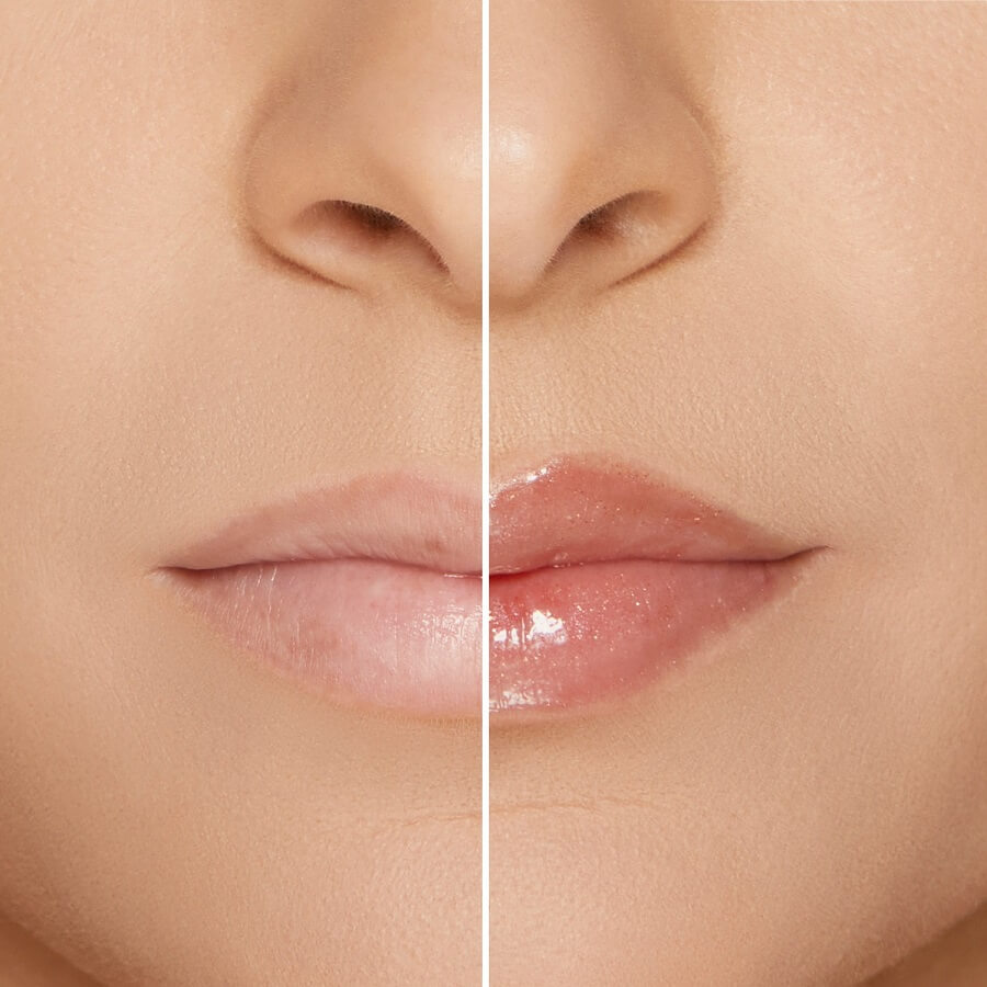 Lip Injection Maximum Plump