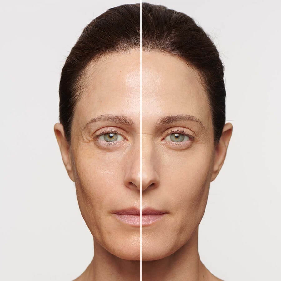 SOS Primer Imperfections