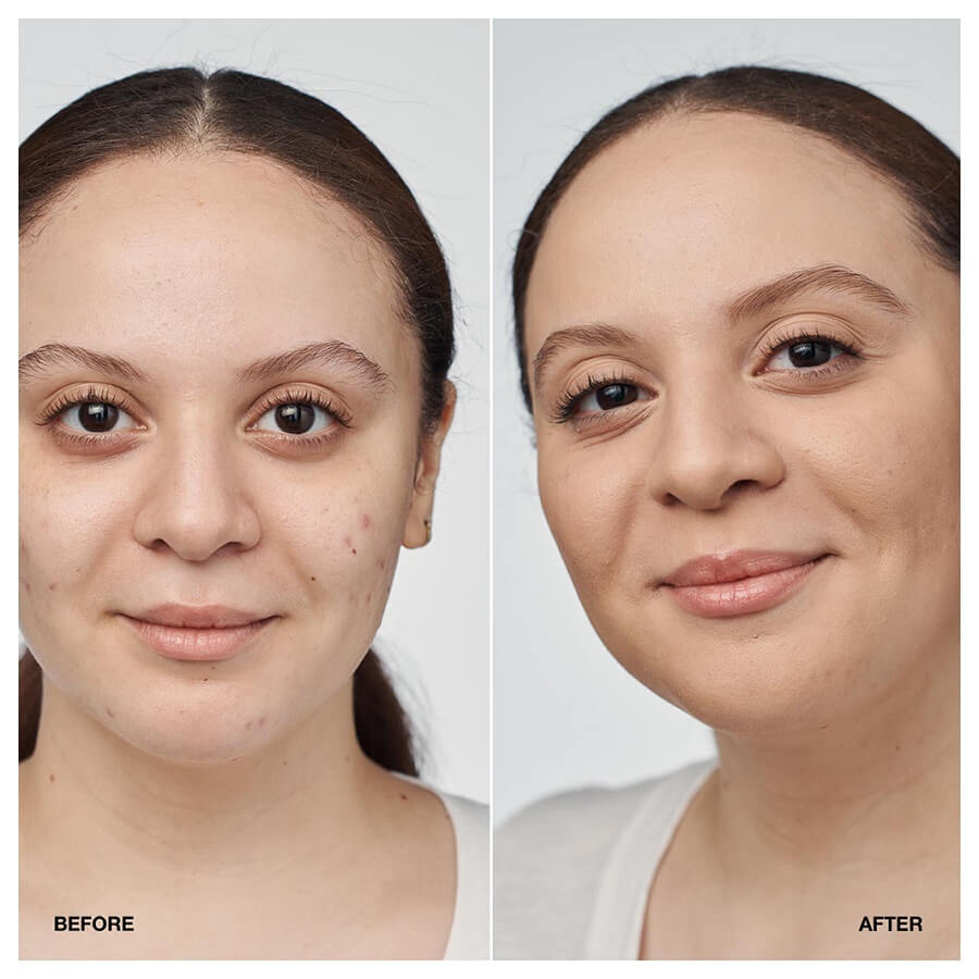 Even Better Clinical Serum Foundation SPF 20