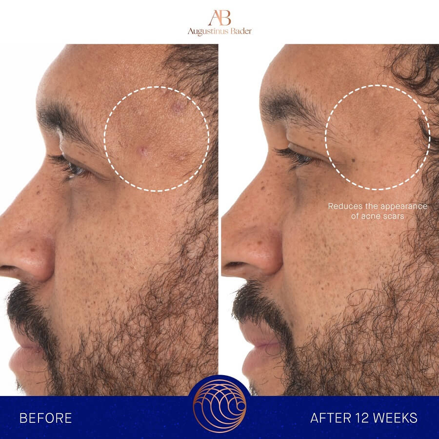 The Retinol Serum
