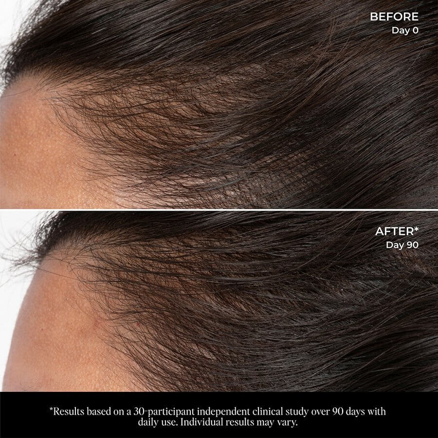 Let There Be Hair Scalp Serum