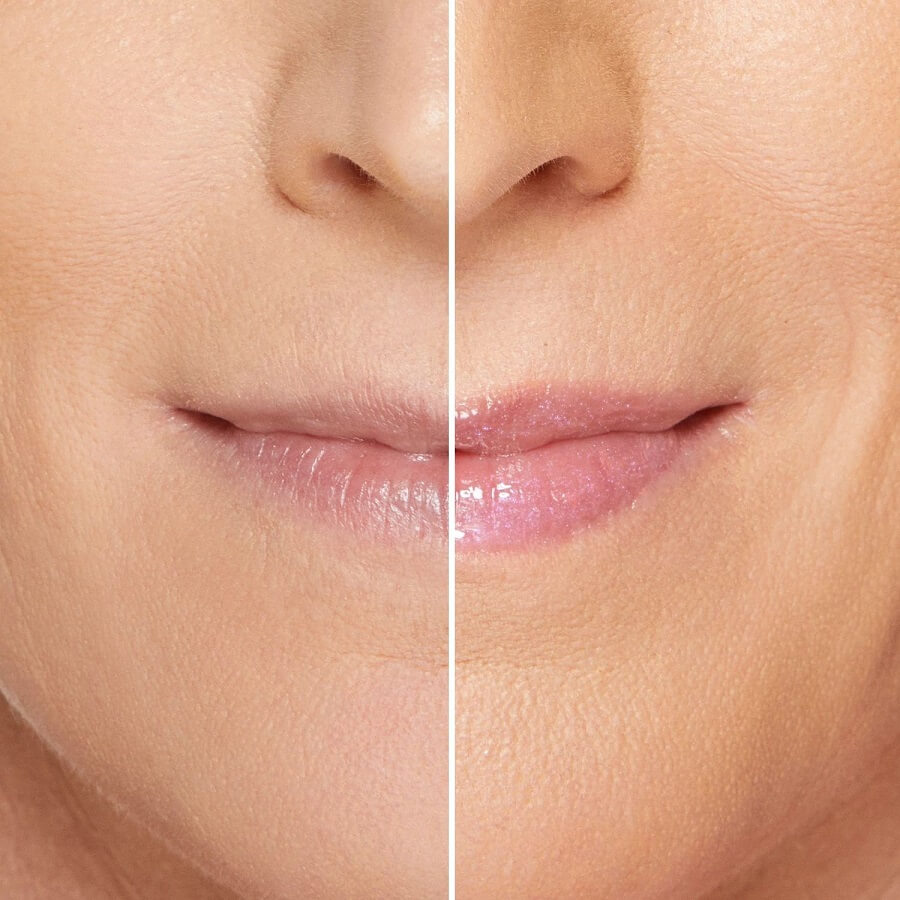 Lip Injection Maximum Plump