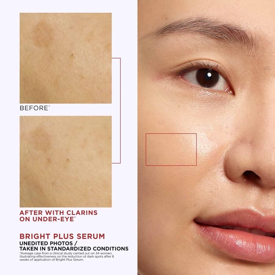 Brightening Dark Spot-Targeting Expert Serum