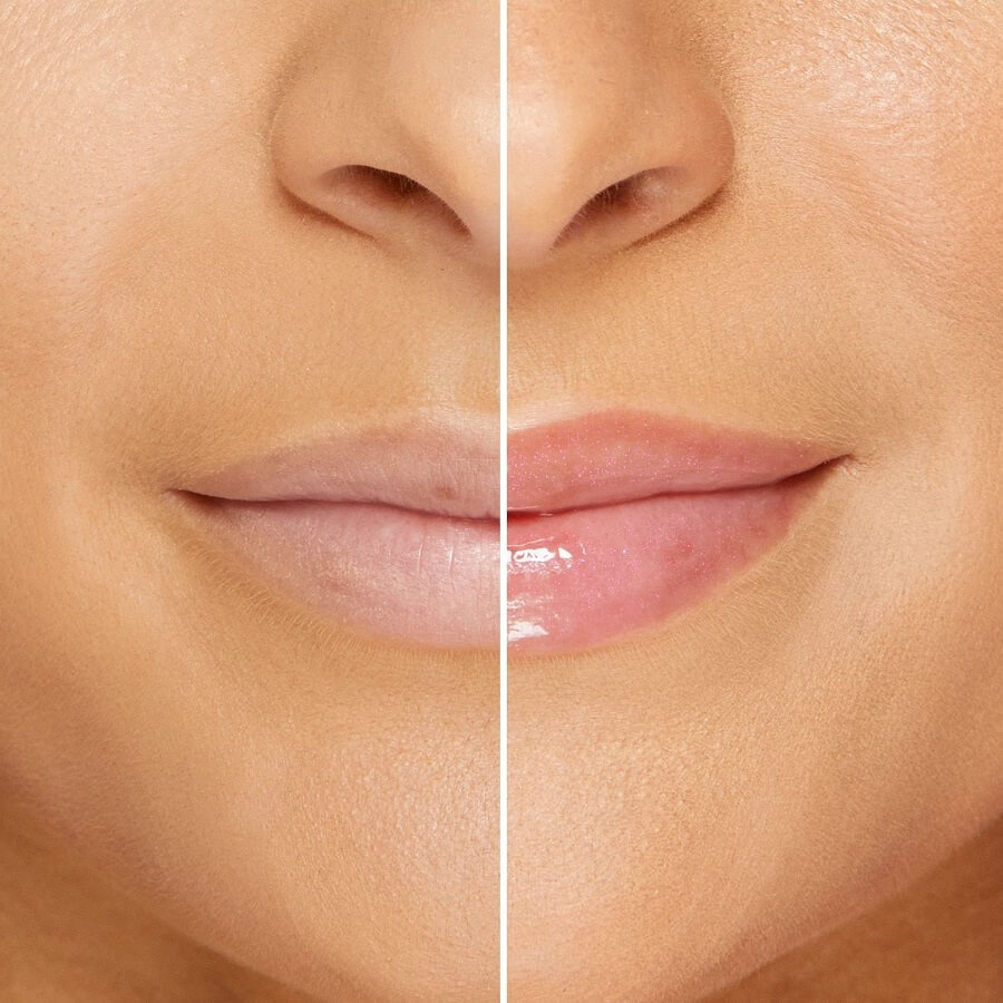 Lip Injection Maximum Plump
