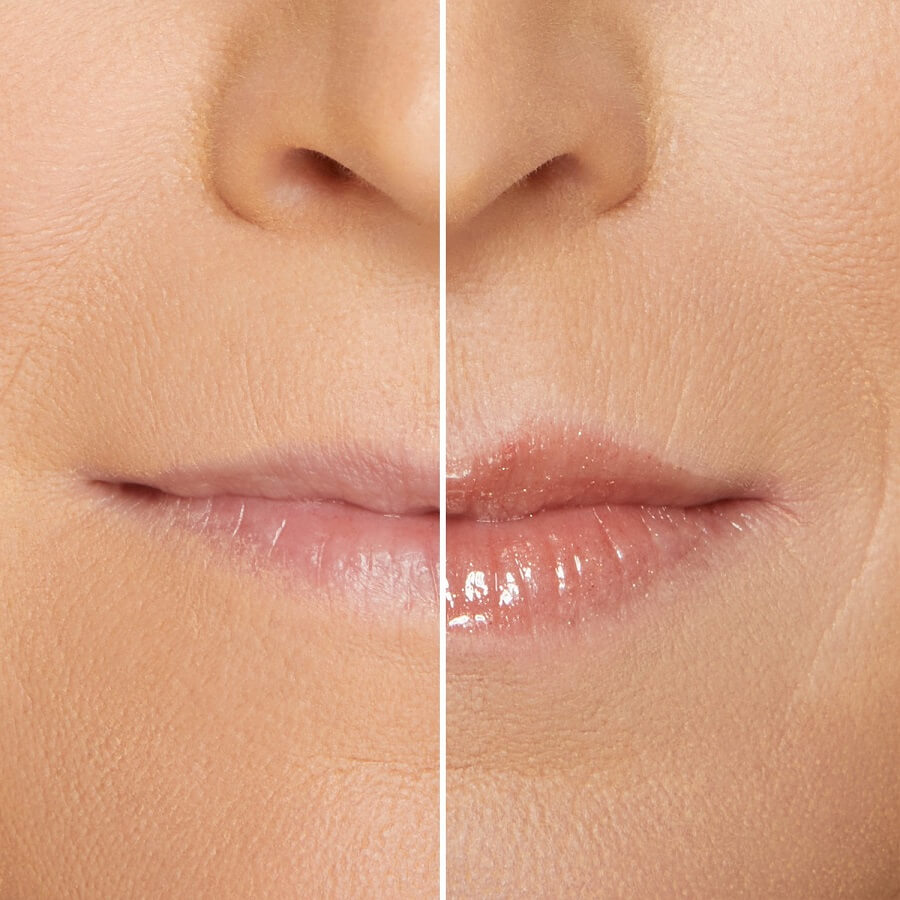 Lip Injection Maximum Plump