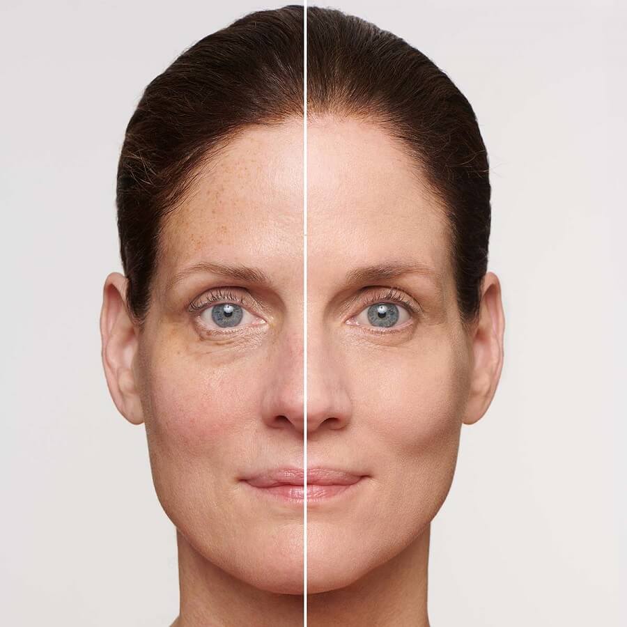 SOS Primer Imperfections